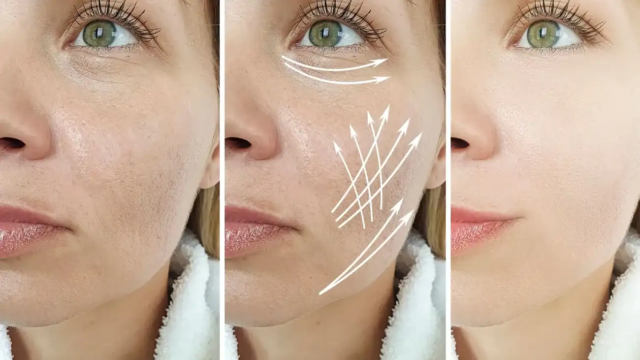 Can One Treatment Really Tackle More Than One Skin Concern Livingston?