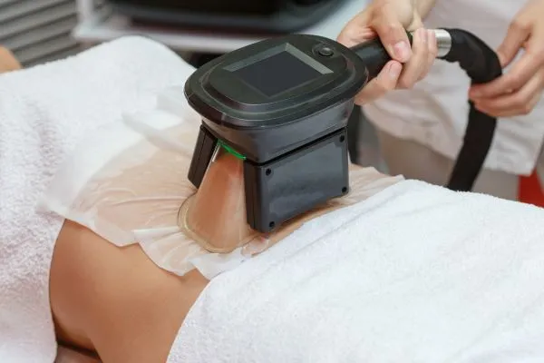 Image of person having fat freezing treatment to help weight gain Livingston