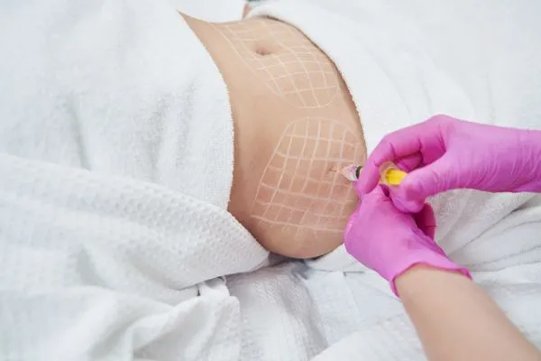 image of fat dissolving injections on love handles to help combat weight gain Livingston