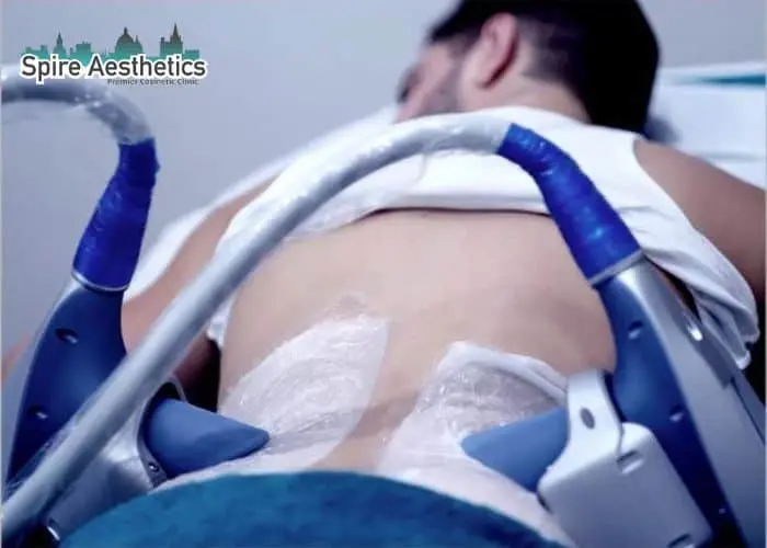 Man having fat freezing treatment done on love handles before a competitions Livingston to create a sculpted look.