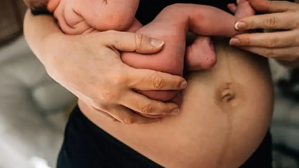 Why Is My Stomach Still Big After Pregnancy Livingston?